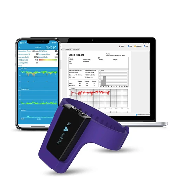 Пульсоксиметр Viatom Visual-Oxy ЄС